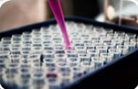 Protein Analysis