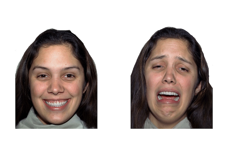 Children in the study looked at faces conveying different emotions onscreen, and eye-tracking technology recorded where their attention veered.