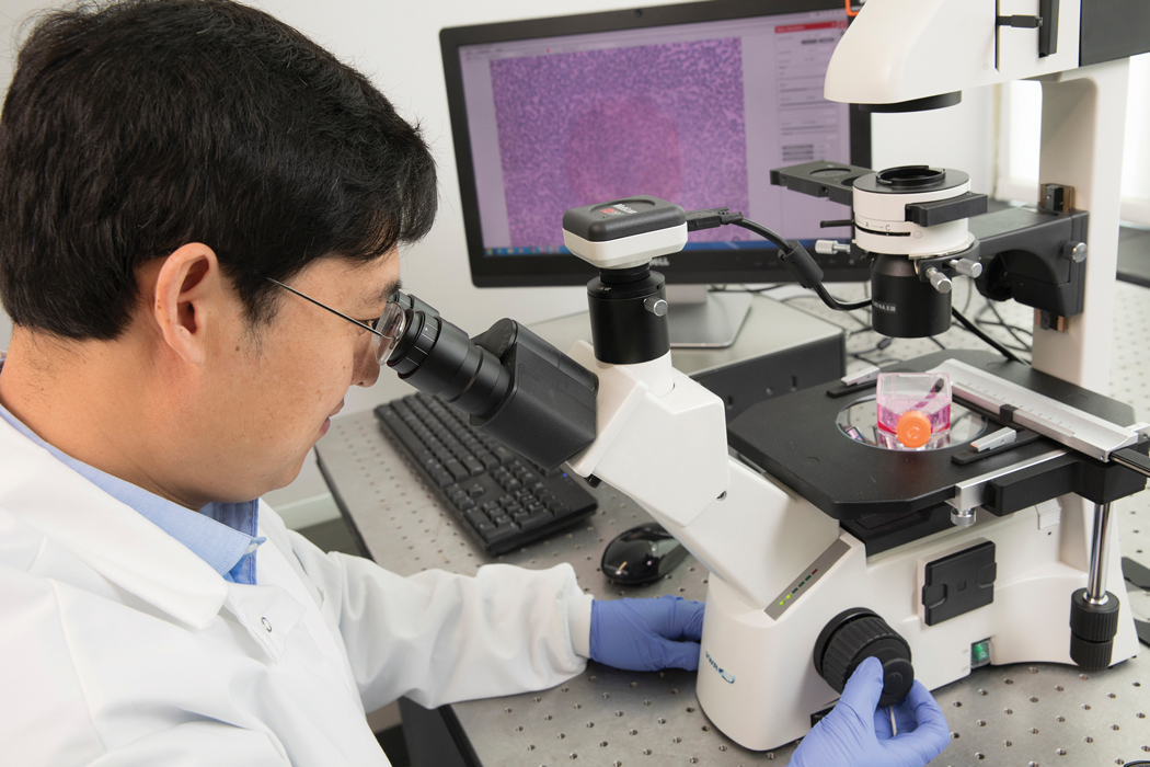 Biomedical engineer Fake “Frank” Lu has concentrated his work on gliomas, which are among the deadliest kind of brain cancer.