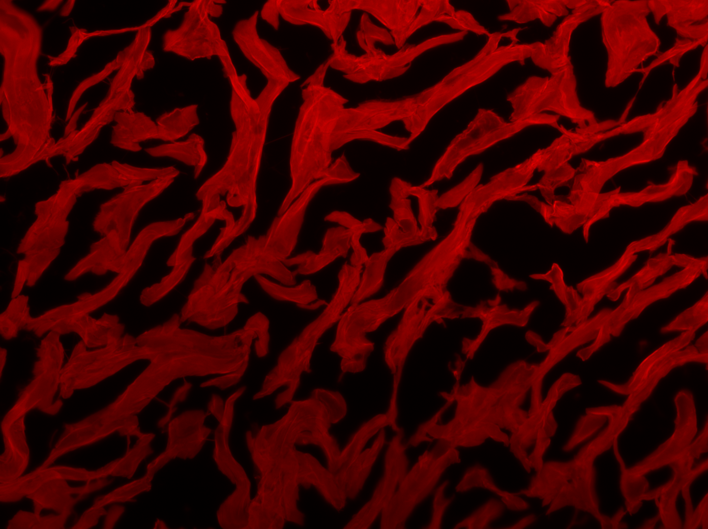 At the annual Art of Science competition, PhD student Niranjana Dhandapani won first place in the Visualizing the Unseen category as well as Best in Show for her photo “Strength of Our Skin.”