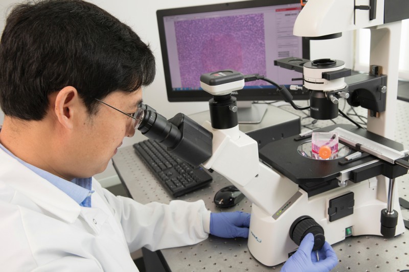 Biomedical engineer Fake “Frank” Lu has concentrated his work on gliomas, which are among the deadliest kind of brain cancer.