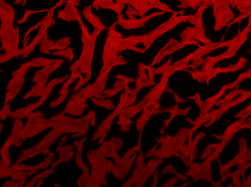 At the annual Art of Science competition, PhD student Niranjana Dhandapani won first place in the Visualizing the Unseen category as well as Best in Show for her photo “Strength of Our Skin.”