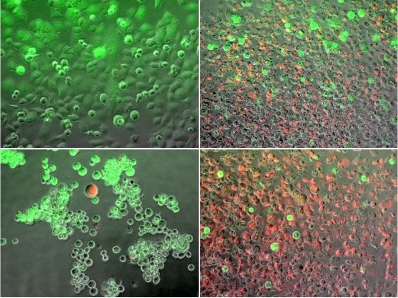Pancreatic cancer cells stained with live/dead fluorescence dyes, with live cells in green and dead cells in red. Pictured are control cells (top left), frozen cells (top right), heated cells (bottom left) and DTA treated cells (bottom right).