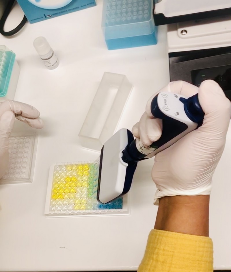 Risana Chowdhury, a doctoral candidate in anthropology, conducts an immune-assay to determine the levels of c-reactive protein in the sera of Guamanian ALS patients and matched controls.