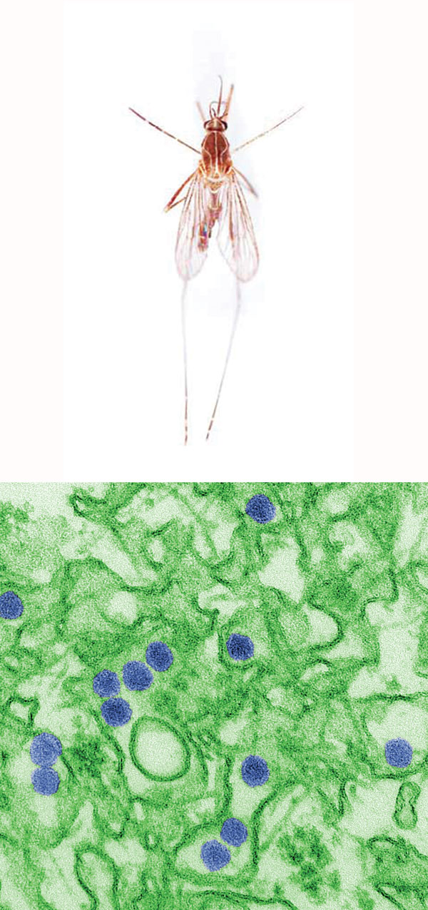 Top: Mosquitos are considered one of the most dangerous creatures on the planet because of their ability to spread deadly diseases. Bottom: Infection with Zika virus (a colorized image is shown here) during pregnancy can cause severe fetal brain defects.