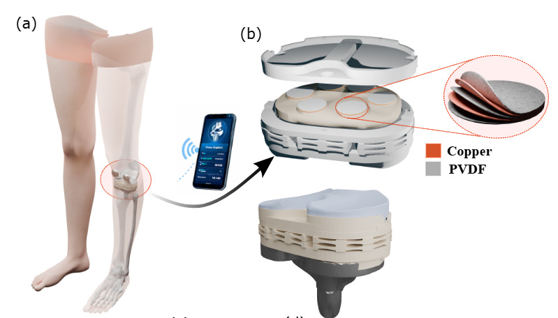 Piezoelectric and triboelectric transducers would convert the knee's movements into small amounts of power that would power sensors.