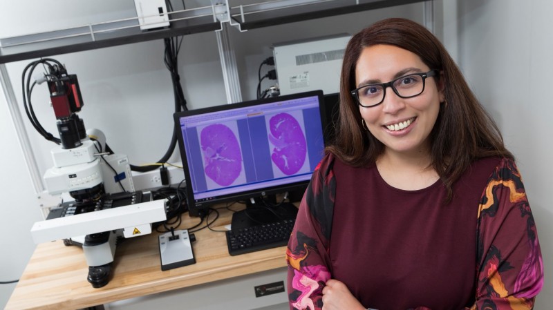 Assistant Professor Melissa Morales with images of the kidneys of a lupus mouse (left) and a healthy control mouse (right).