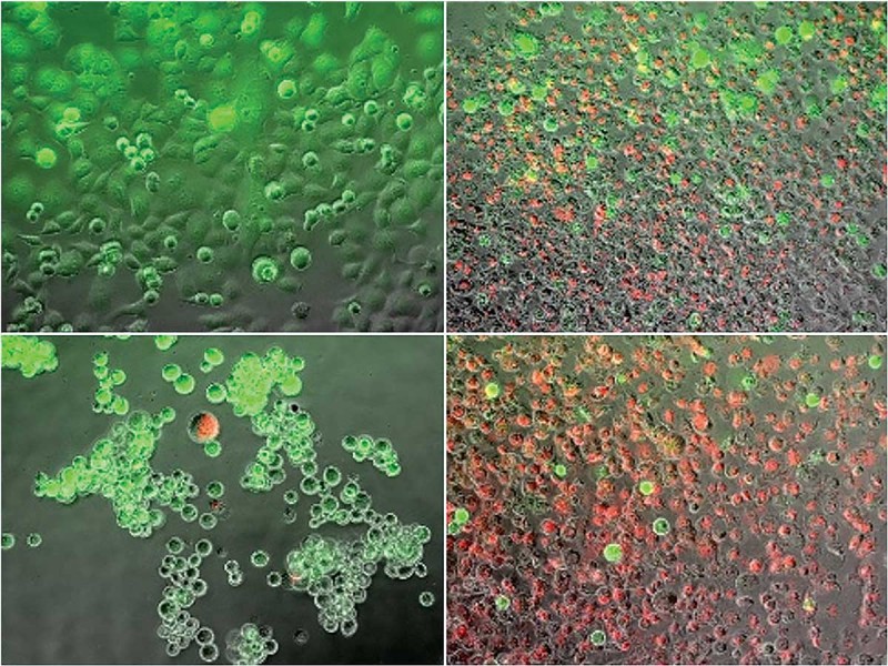 These are pancreatic cancer cells stained with live/dead fluorescence dyes, with live cells in green and dead cells in red. Pictured are control cells (top left), frozen cells (top right), heated cells (bottom left) and dual thermal ablation-treated cells (bottom right).