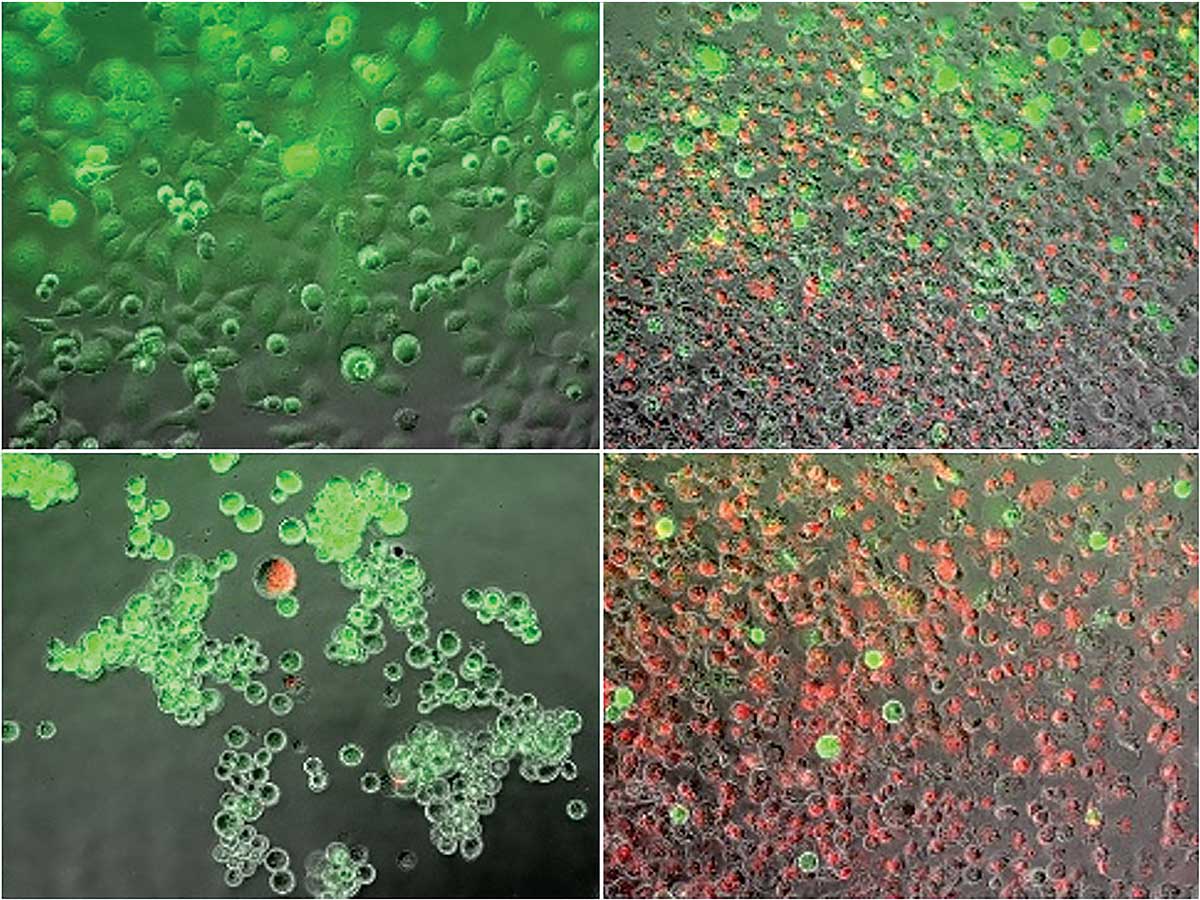 These are pancreatic cancer cells stained with live/dead fluorescence dyes, with live cells in green and dead cells in red. Pictured are control cells (top left), frozen cells (top right), heated cells (bottom left) and dual thermal ablation-treated cells (bottom right).