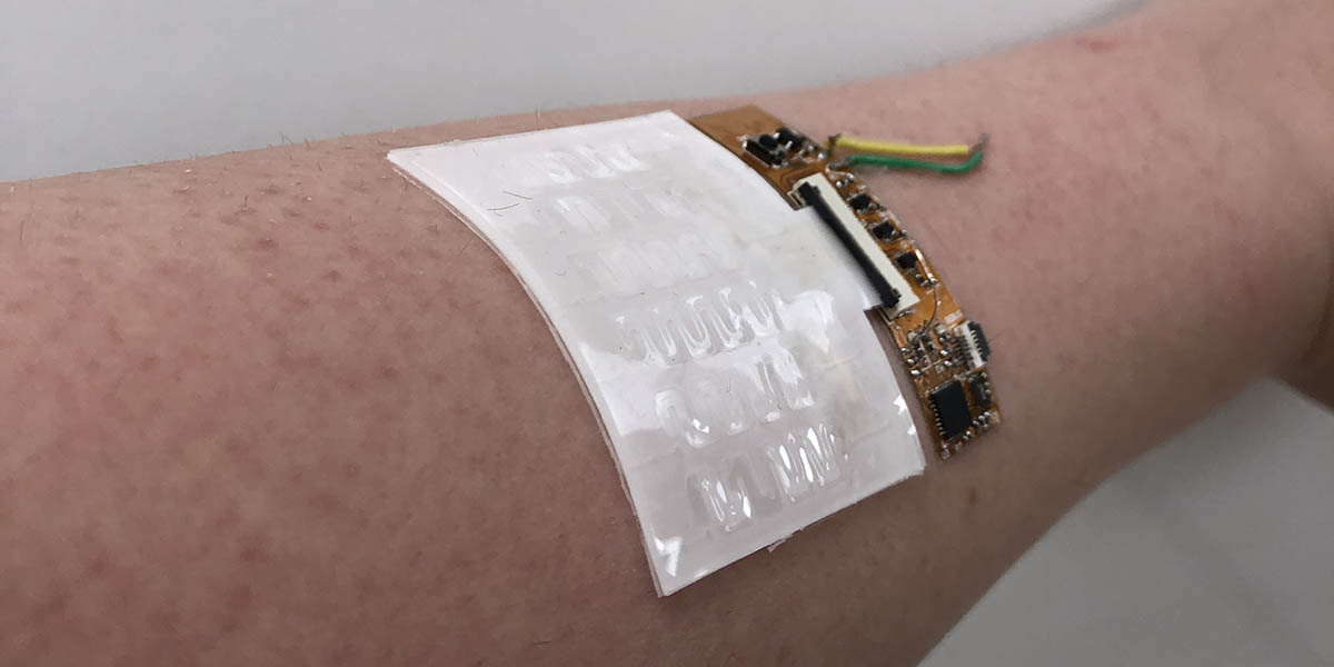 A new device developed at Binghamton University can collect sweat at specified time periods, which can improve analysis of key biomarkers like cortisol.